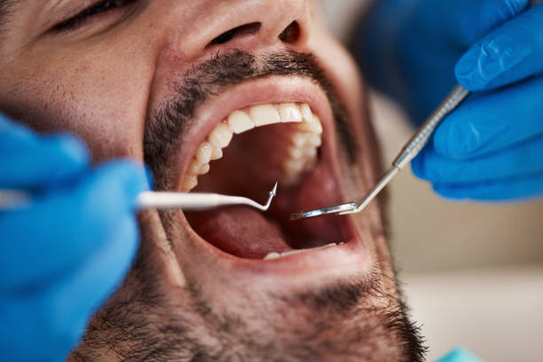 Best Emergency Care for Gum Disease in Montrose, MN