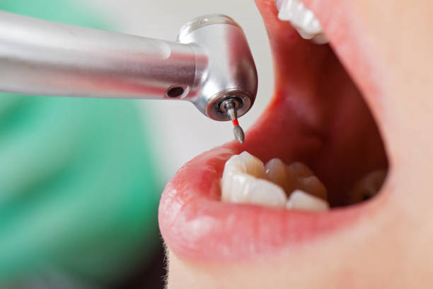 Best After-Hours Dental Care in Montrose, MN